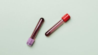 telecom fraud prevention department