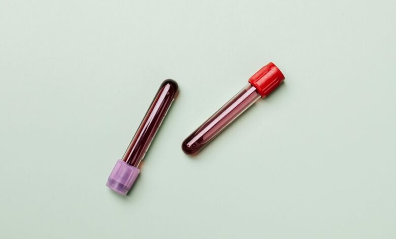 telecom fraud prevention department